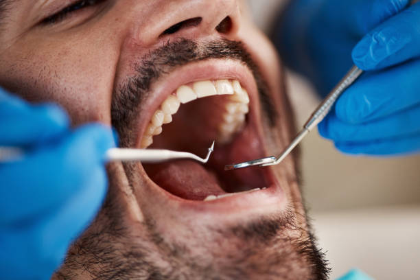 Best Pediatric Emergency Dentist in Riddle, OR